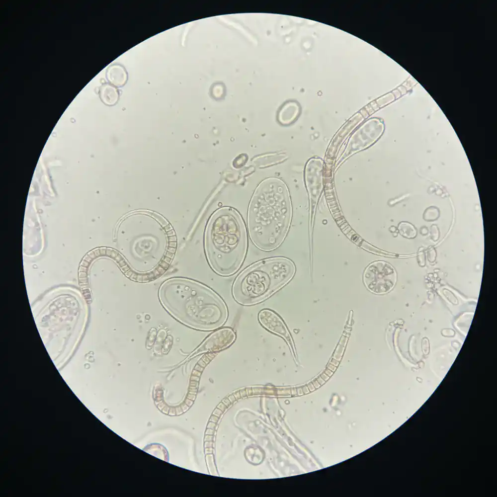 Microscopic analysis of poultry parasites
